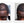 Before and after image of a man with short curly black hair and thin hair around his frontal scalp region